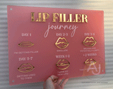 Lip Filler Journey Aftercare Advice Acrylic A3 Wall Sign | Beauty Sign | Business Sign | Spa Sign | Salon Sign | Salon Decor