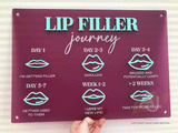 Lip Filler Journey Aftercare Advice Acrylic A3 Wall Sign | Beauty Sign | Business Sign | Spa Sign | Salon Sign | Salon Decor