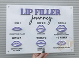 Lip Filler Journey Aftercare Advice Acrylic A3 Wall Sign | Beauty Sign | Business Sign | Spa Sign | Salon Sign | Salon Decor