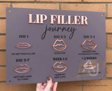 Lip Filler Journey Aftercare Advice Acrylic A3 Wall Sign | Beauty Sign | Business Sign | Spa Sign | Salon Sign | Salon Decor